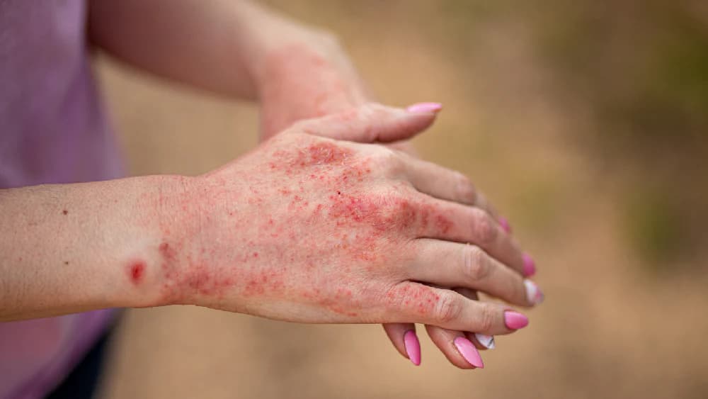 The Sulfate-Free Revolution: Why Sodium Lauroyl Sarcosinate is the Future